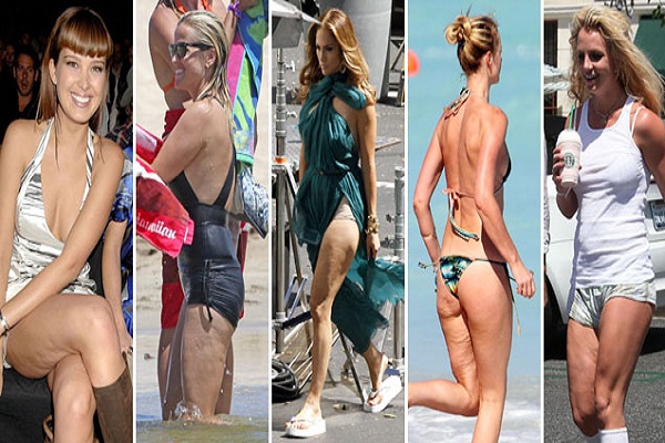 celebrities with cellulite, celebrities with cellulite legs, celebrities with cellulite, hollywood celebrities with cellulite, hot celebrities with cellulite, female celebrities with cellulite, celebrities with cellulite 2015